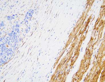 Reagente soluzione colorante - CCM-0213 - Celnovte Biotechnology Co., Ltd. - anticorpo / colorante / per tessuti