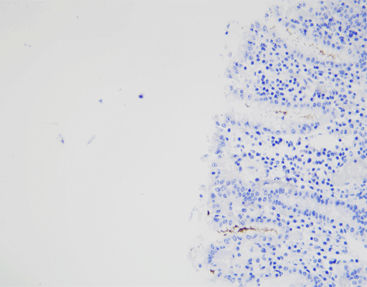 Reagente soluzione colorante - CHM-0173 - Celnovte Biotechnology Co., Ltd. - anticorpo / colorante / per tessuti