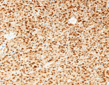 Reagente soluzione colorante - CIM-0200 - Celnovte Biotechnology Co., Ltd. - anticorpo / colorante / per tessuti