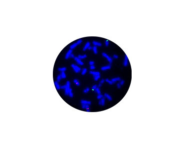 Kit di test della febbre tifoide - CF1236 - Celnovte Biotechnology Co., Ltd. - da ricerca / oncologico / per ricerca medica