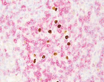 Kit di test per malattie infettive - Celnovte Biotechnology Co., Ltd. - del virus di Epstein-Barr / a immunofluorescenza / molecolare