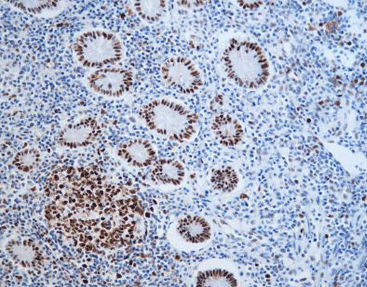 Reagente soluzione colorante - CMM-0202 - Celnovte Biotechnology Co., Ltd. - anticorpo / colorante / per tessuti