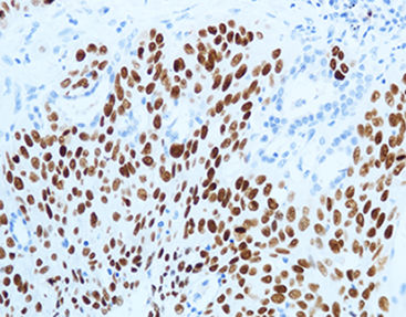 Reagente soluzione colorante - CPM-0133 - Celnovte Biotechnology Co., Ltd. - anticorpo / colorante / per tessuti