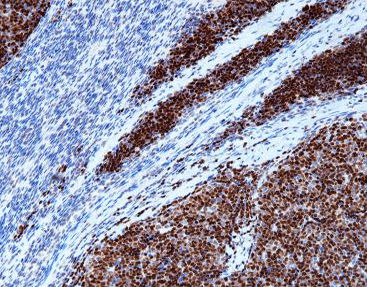Reagente DNA polimerasi - CTM-0132 - Celnovte Biotechnology Co., Ltd. - soluzione colorante / enzima / colorante
