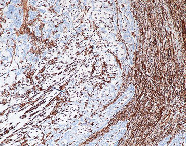 Reagente soluzione colorante - CVM-0040 - Celnovte Biotechnology Co., Ltd. - anticorpo / colorante / per tessuti