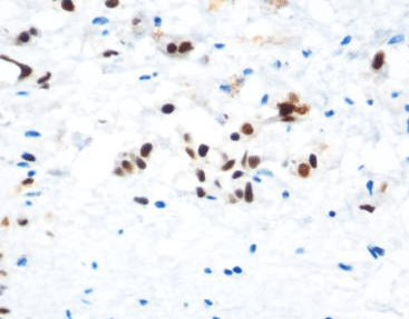Reagente soluzione colorante - CAM-0211 - Celnovte Biotechnology Co., Ltd. - anticorpo / colorante / per citologia