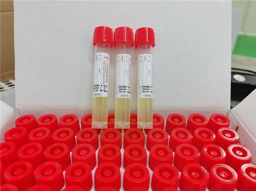 Provetta per prelievi da laboratorio - Cangzhou Yongkang Medical Devices Co., Ltd. - cilindrico / nasale / faringeo