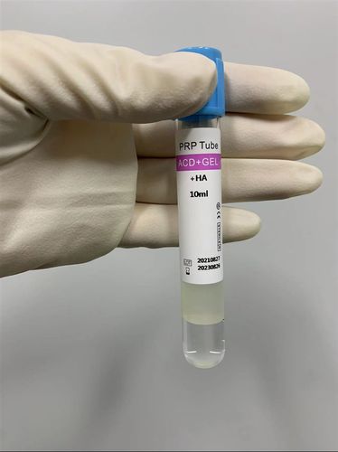 Provetta per prelievi per plasma ricco in piastrine - Cangzhou Yongkang Medical Devices Co., Ltd. - cilindrico / di sangue / al plasma