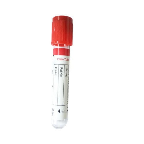 Provetta per prelievi per diagnostica - Cangzhou Yongkang Medical Devices Co., Ltd. - per immuno-analisi / cilindrico / di sangue