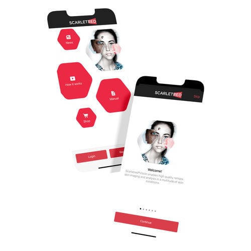 Applicazione android di controllo - Scarletred®Vision - SCARLETRED Holding GmbH - di acquisizione / di calibrazione / dermatologia
