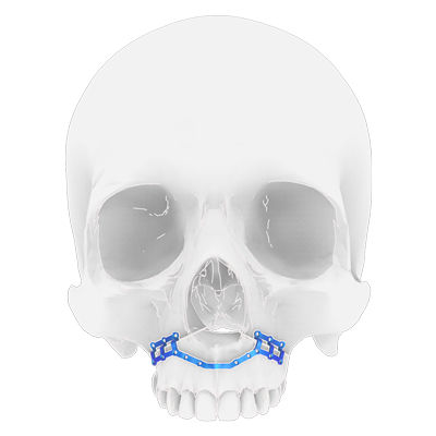 Placca per osteotomia per mascella - Osteophoenix - in titanio