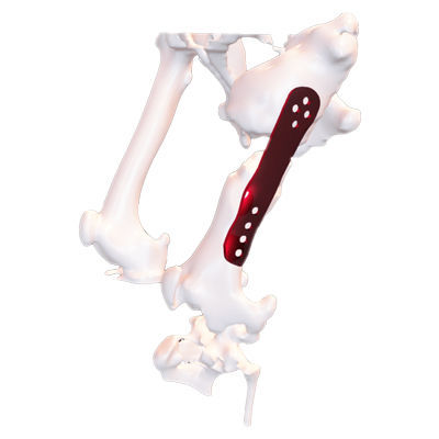 Placca ossea di compressione a uso veterinario generica - Osteophoenix