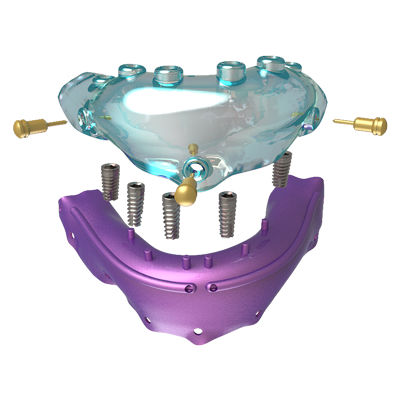 Guida chirurgica per implantologia dentale - Osteophoenix