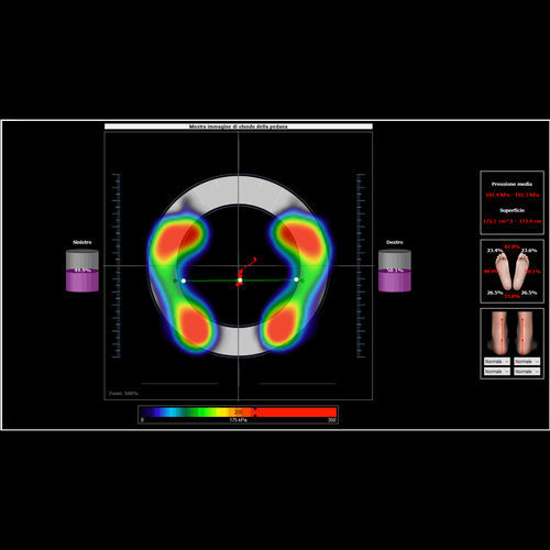 Software di acquisizione - BioPostural System® - Microlab - per podologia / per piattaforma stabilometrica / per piattaforma baropodometriche