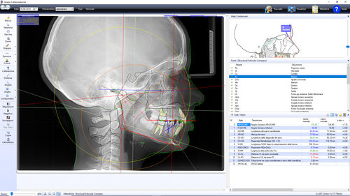 Software per ortodonzia - OrthoTP - Microlab - di analisi