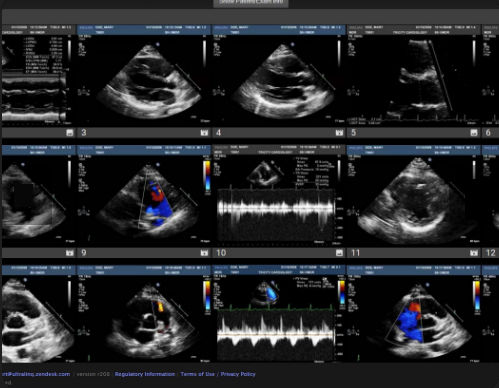 PACS per diagnostica per immagini - Cardiology - UltraLinq