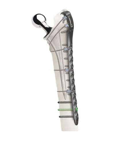 Placca di compressione per acetabolo - Wuxi Betta Medical Technology - per frattura femorale periprotesica / per testa del femore / in metallo