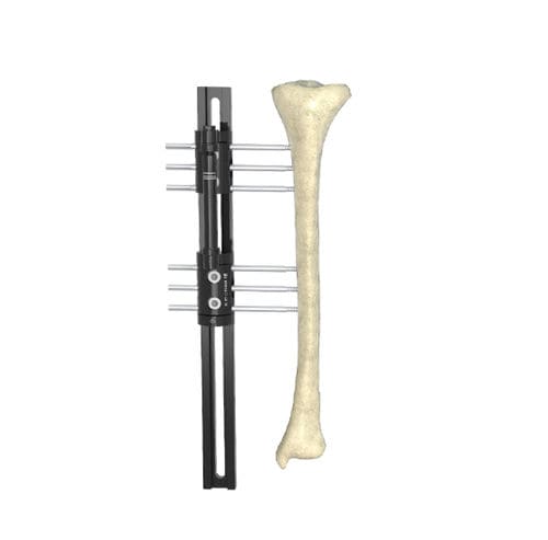 Fissatore esterno modulare - Wuxi Betta Medical Technology - tubolare / per adulti
