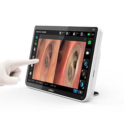 Videoprocessore per endoscopia - P1 - Endoso Life Technology - con porte USB / con videomonitor / con videoregistratore