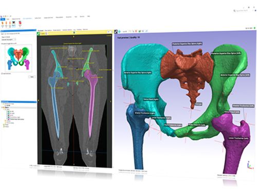 Modulo software medico - Simpleware Automated Solution  - Synopsys Simpleware Product Group - chirurgico / di pianificazione / di progettazione