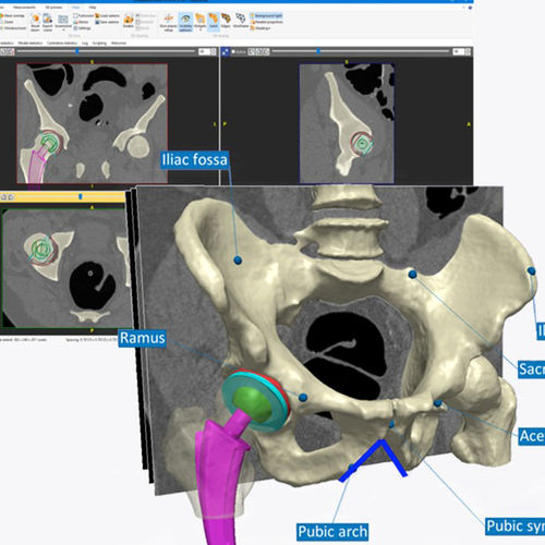 Software clinico - Simpleware ScanIP  - Synopsys Simpleware Product Group - per diagnostica per immagini / preclinico / preoperatorio