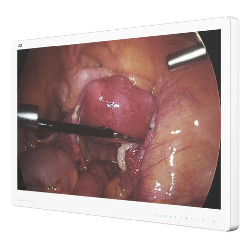 monitor per endoscopia - Hikimaging