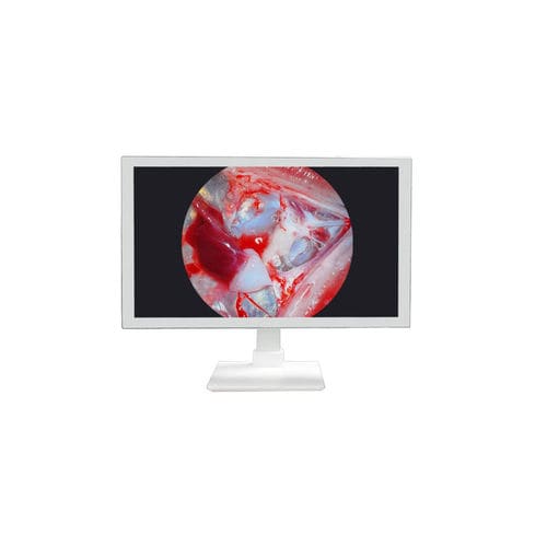 Monitor medico - TU-24M1080P - Shenzhen Tuyou Medical Imaging Co., Ltd.​ - per sala operatoria / chirurgico / 27"