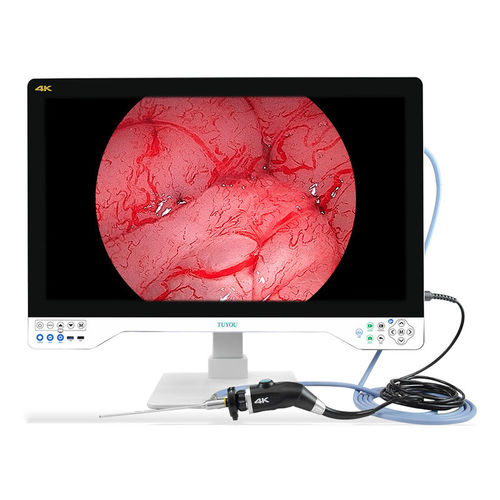 Videocamera medica - TU-32LSD1A - Shenzhen Tuyou Medical Imaging Co., Ltd.​ - chirurgica / digitale / VGA