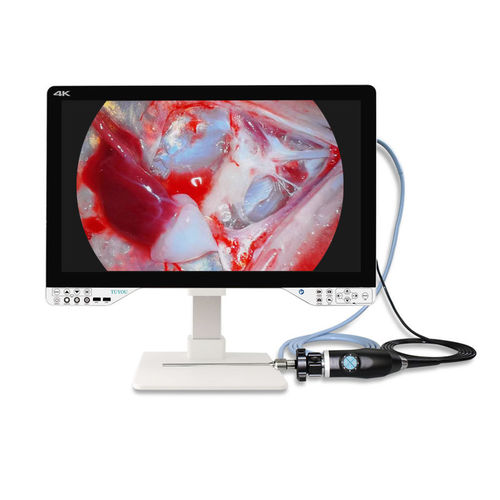 Fotocamera per endoscopio - TU-27LSD1A - Shenzhen Tuyou Medical Imaging Co., Ltd.​ - medica / digitale / ad alta definizione
