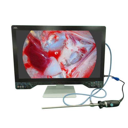 Fotocamera per endoscopio - TU-32LSD1A - Shenzhen Tuyou Medical Imaging Co., Ltd.​ - medica / chirurgica / digitale