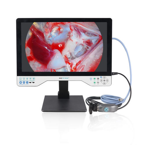 Fotocamera per endoscopio - TU-24LSD101B - Shenzhen Tuyou Medical Imaging Co., Ltd.​ - medica / digitale / VGA