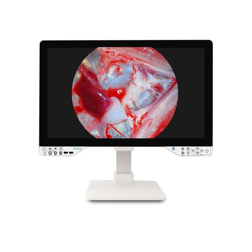 Fotocamera per endoscopio - TU-27LSD2B - Shenzhen Tuyou Medical Imaging Co., Ltd.​ - digitale / VGA / ad alta definizione