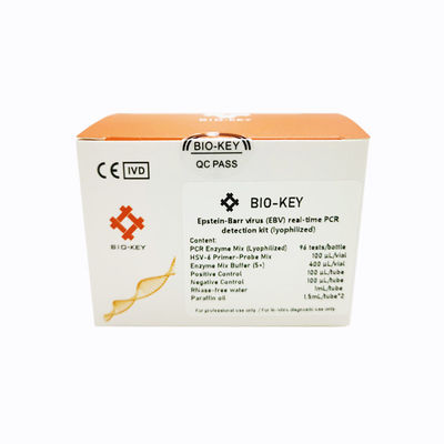 Kit di test per malattie infettive - BIK-QL-H0017 - Biokey Health - del virus di Epstein-Barr / di siero / al plasma