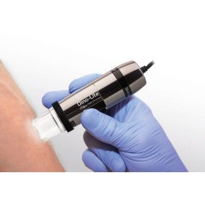 Videodermatoscopio - Dino-lite - Comitas e- Health - LED bianca