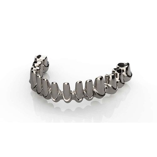 Ponte dentale in metallo - Kangli Medical - per denti anteriori