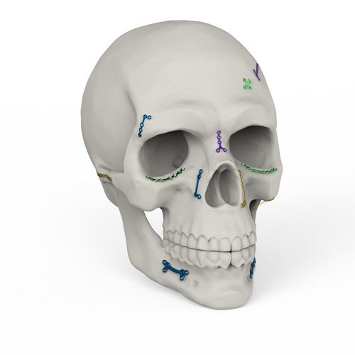 sistema di fissazione cranica non assorbibile - Kangli Medical