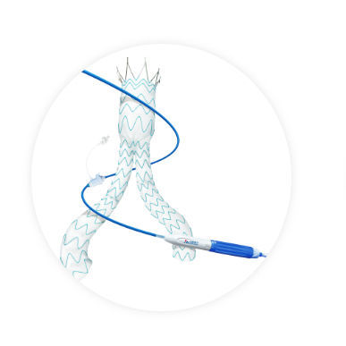 Innesto stent aorta addominale - Minos™ - Endovastec - arteria iliaca / in nitinol / in polietilene
