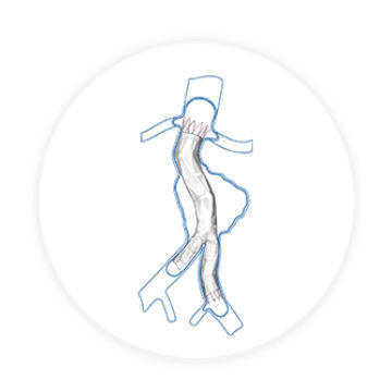 Innesto stent aorta addominale - Aegis™ - Endovastec - in nitinol / in ePTFE