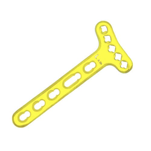 Placca di compressione per radio - SDP-49 - Chongqing FWS Medical Devices - distale / palmare / bloccata