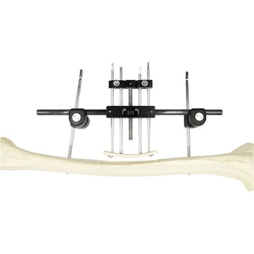 Fissatore esterno per femore - Chongqing FWS Medical Device - tubolare / per adulti
