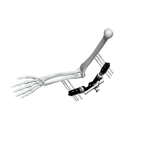 Fissatore esterno per gomito - FE5M-D040 - Chongqing FWS Medical Device - tubolare / per adulti