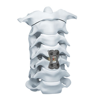 Placca per artrodesi cervicale - CAP  - Mediox - 1 livello