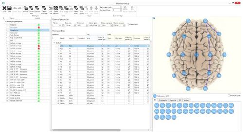 Software per EEG - BRAIN QUICK® - Natus Micromed - per ospedale / per cartelle cliniche elettroniche / per terapia intensiva