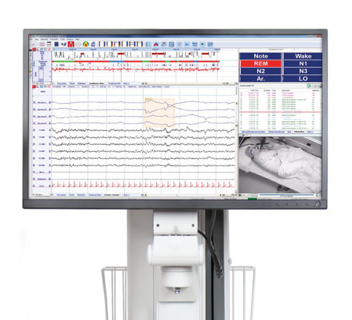 Software medico - SleepRT™ - Natus Micromed - clinico / per EMG / neurologico