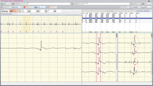 Software di gestione dati - NEUROWERK® - Natus Micromed - di misura / di valutazione / per EEG