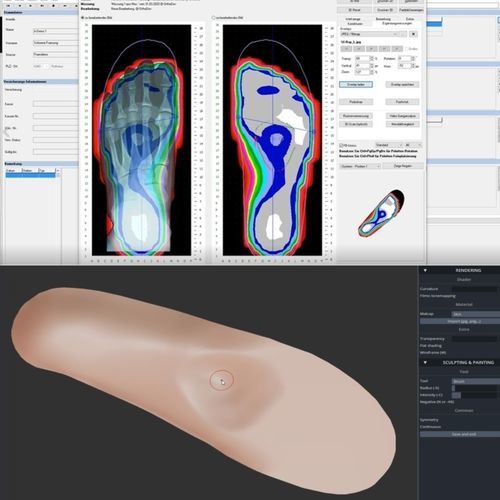 Software di progettazione di solette ortopediche - OrthoWin - Orthema Service - per podologia / di piede / automatizzato