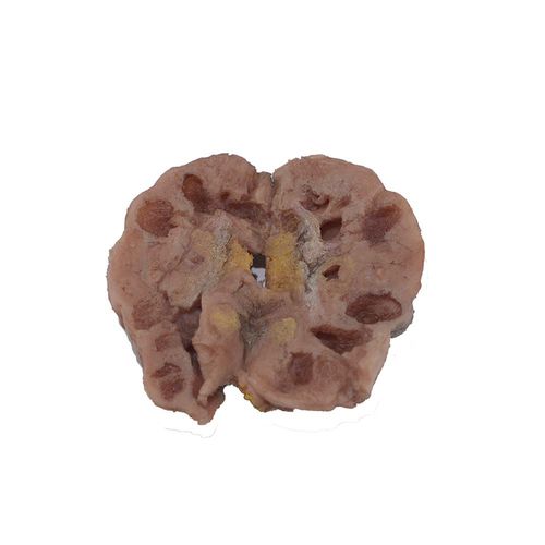 Modello anatomico rene - PM-001 - MeiWo Science - per l’educazione alla salute / ad uso didattico / oncologico