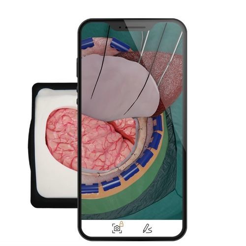 Applicazione mobile di pianificazione - UpSurgeOn - didattica / medica / per neurochirurgia