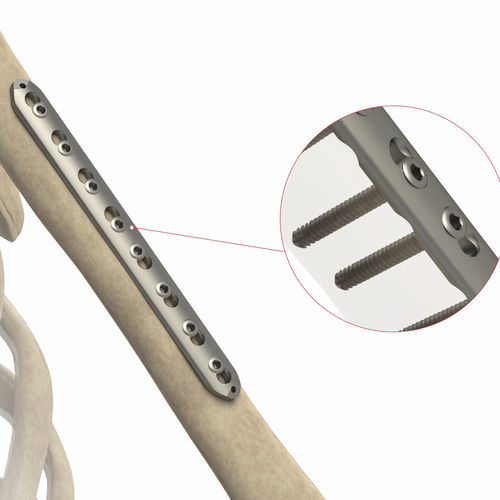 Placca di compressione per radio - AS.ST.068 - Ases Orthopedics - mediale / bloccata / non bloccata