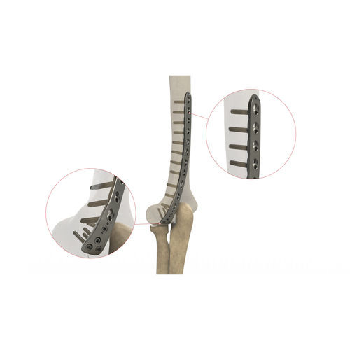 Placca di compressione per omero - AS.E.023 - Ases Orthopedics - distale / posterolaterale / bloccata